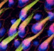 Imagen de clulas ciliadas del odo interno